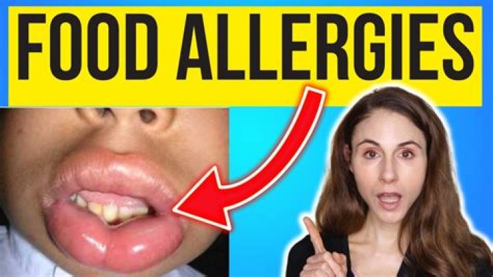 allergic to raspberries