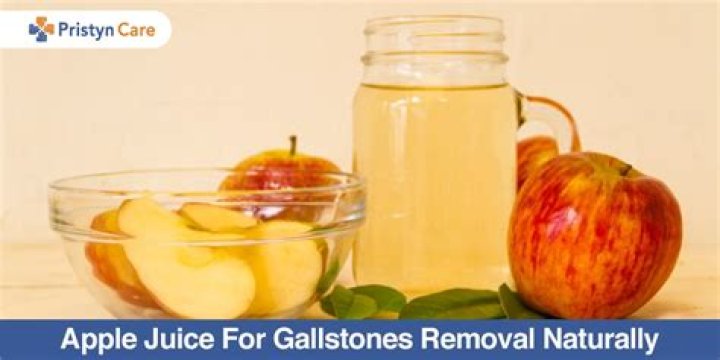 apple juice for gallbladder