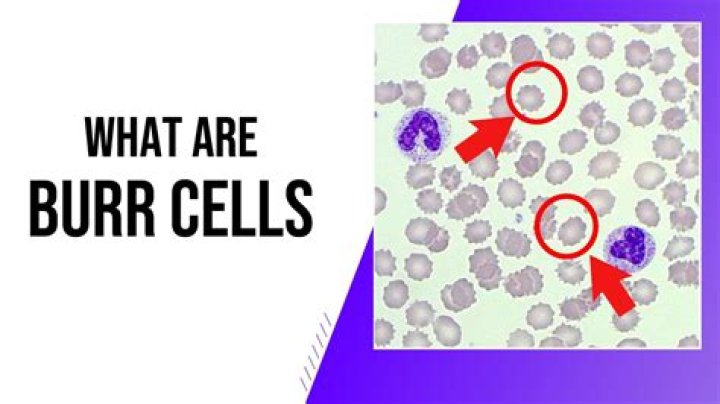 are burr cells bad