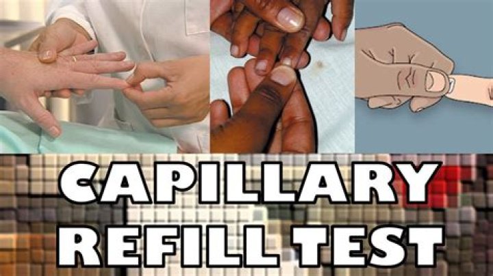 brisk capillary refills