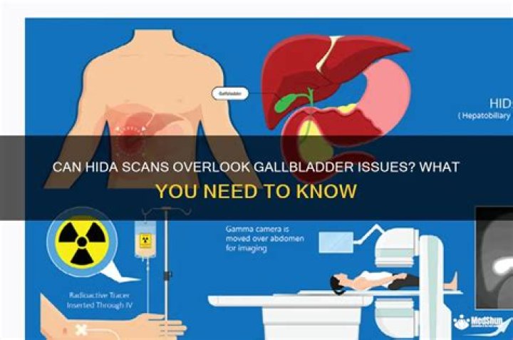 can hida scan miss gallbladder problems