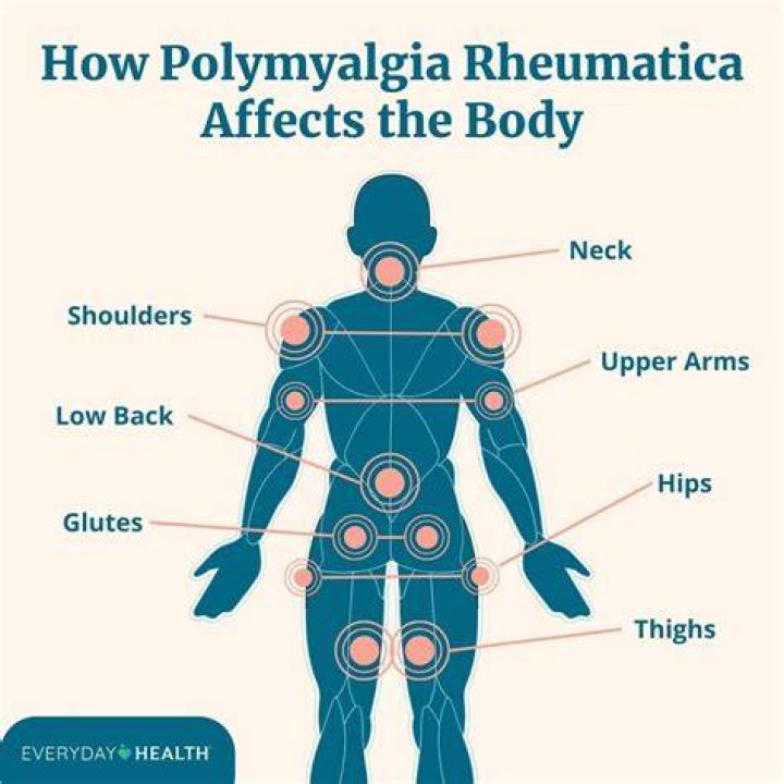 can you die from polymyalgia rheumatica