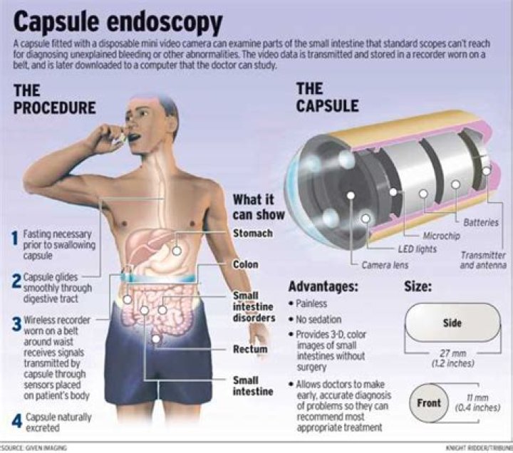 capsule endoscopy cost