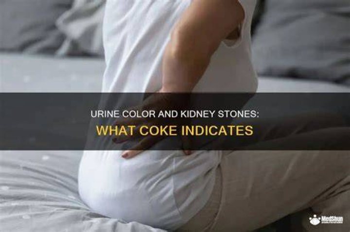 does diet coke cause kidney stones