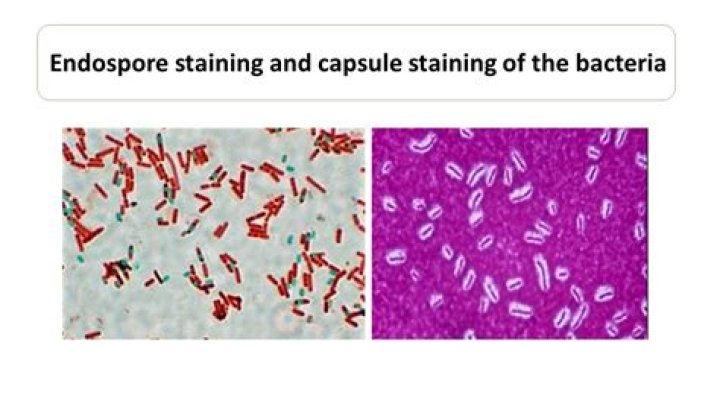endospore stain positive and negative results