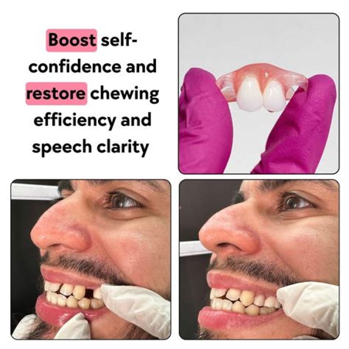 flipper tooth cost