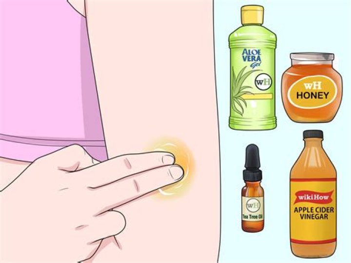 how to get rid of a scab overnight