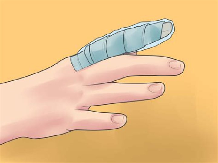 how to splint a pinky finger