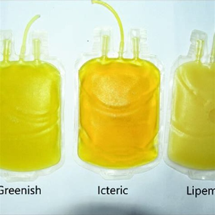 icteric plasma