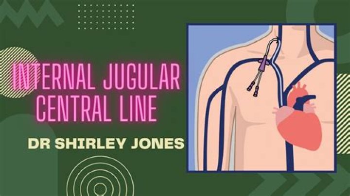 is an ej a central line