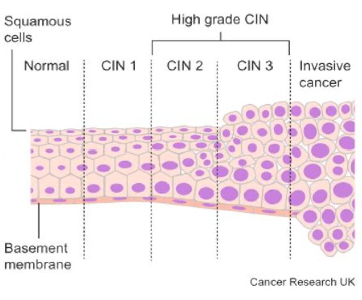 is cin 1 contagious