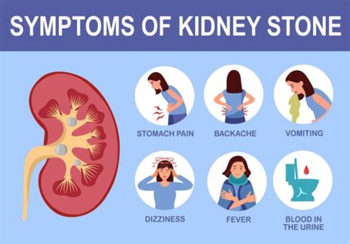 is sprite good for kidney stones