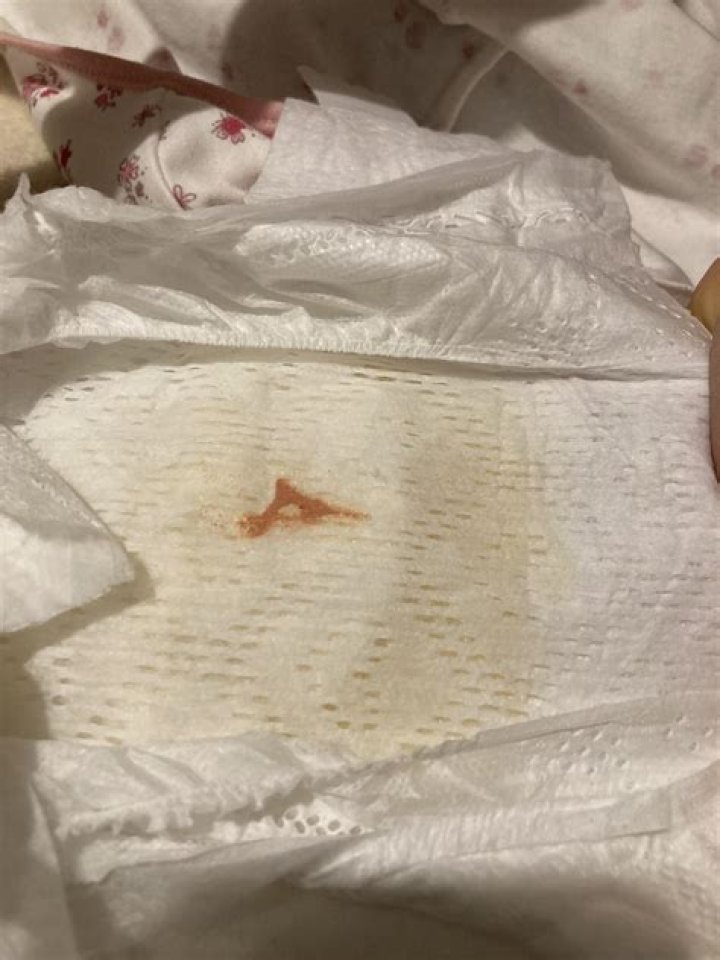 newborn girl discharge