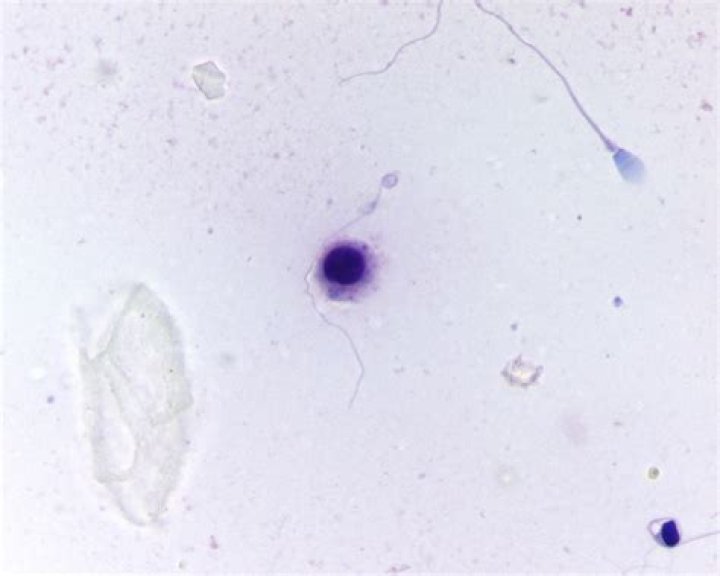 nigrosin and crystal violet dangerous