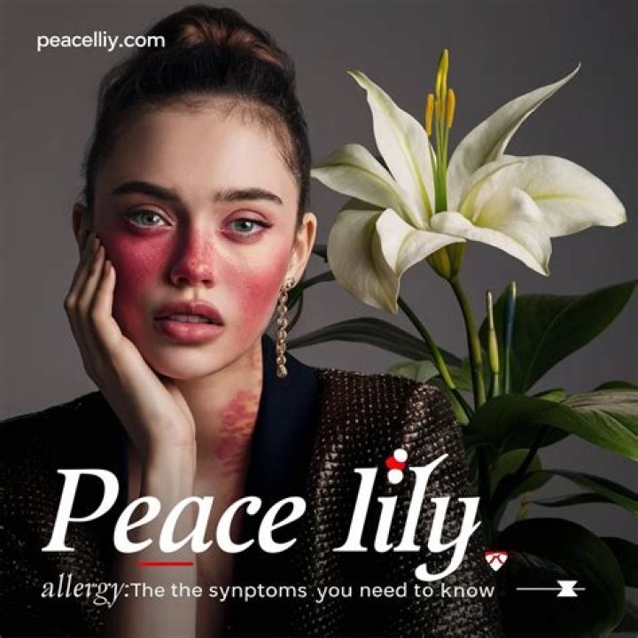peace lily allergy