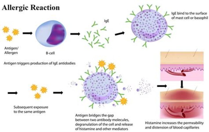 proactive allergic reaction