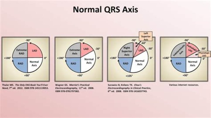 r axis normal range