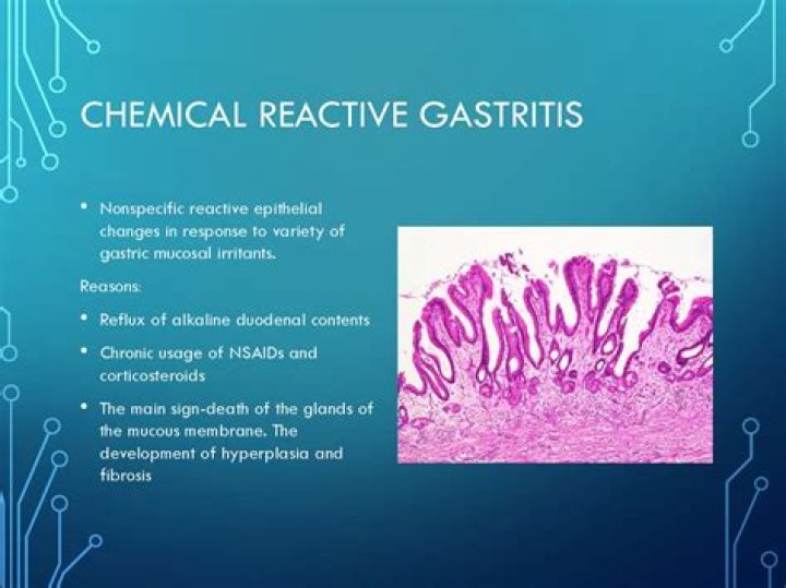 reactive gastropathy treatment
