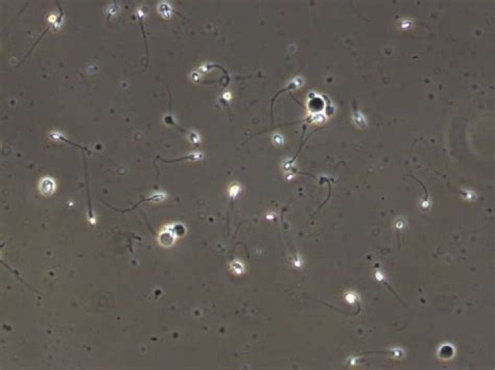 sperm detection light app