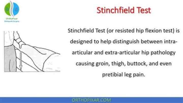 stinchfield test
