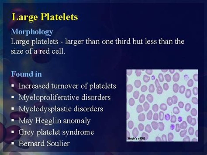 what does large platelets mean