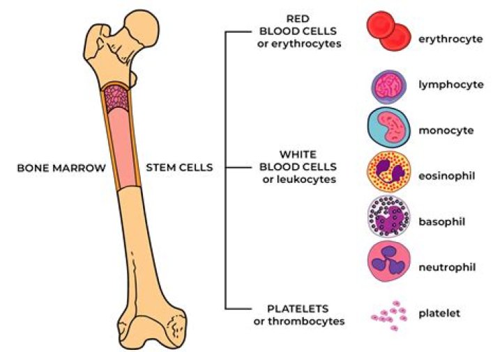 what is death from myelofibrosis like