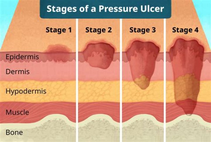 when to go to hospital for ulcer pain