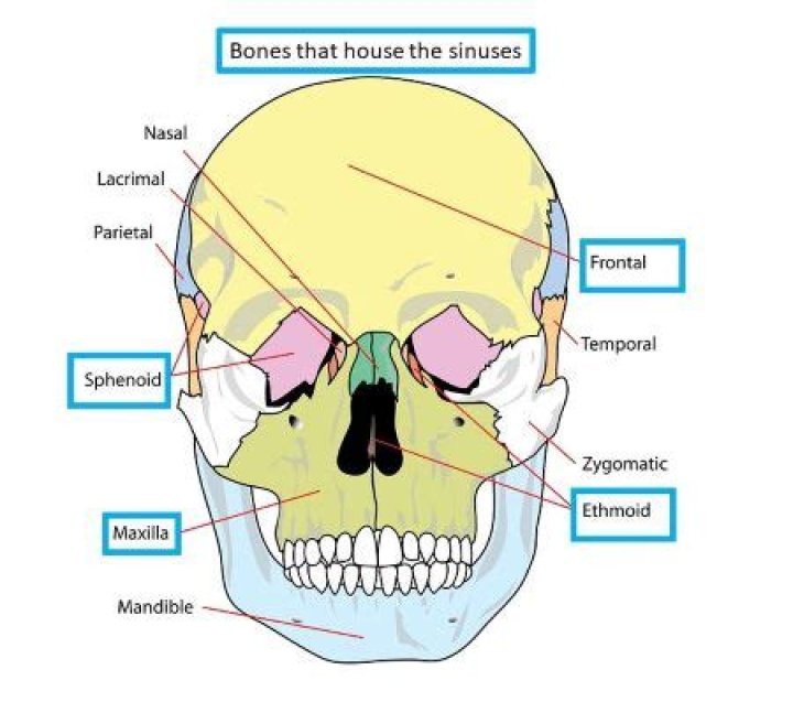 which of the following facial bones contain a sinus?