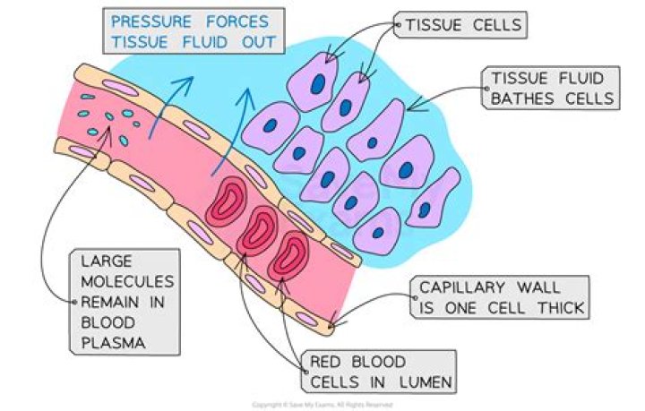 which term refers to excessive fluid accumulation in body tissues?