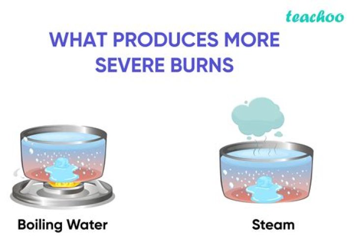 why is a steam burn more damaging than a burn from boiling water at the same temperature?