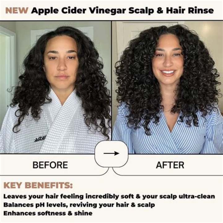 will vinegar dissolve hair